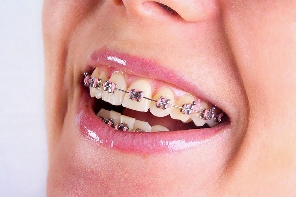 Khám phá 12 địa chỉ nha khoa quận Phú Nhuận uy tín tại TP HCM