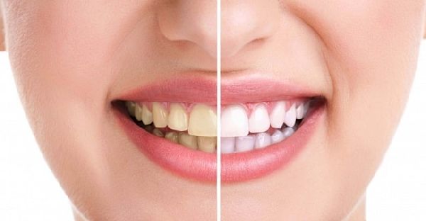 Top 7+ Nha Khoa uy tín tốt Hóc Môn TP HCM