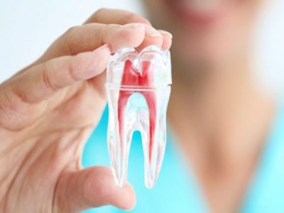 Top 7+ địa chỉ điều trị tủy uy tín Tp.HCM