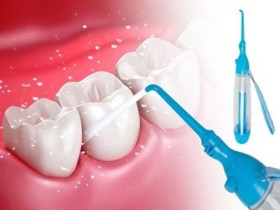 Top 7+ địa chỉ cạo vôi răng uy tín Tp.HCM