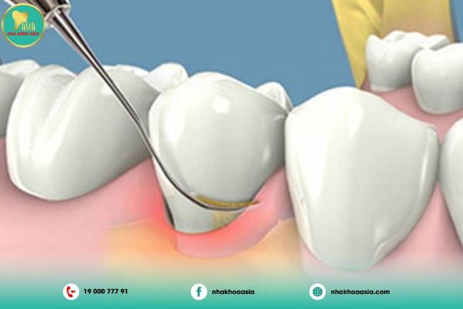 Địa chỉ Phòng khám nha khoa uy tín tốt Biên Hòa Đồng Nai