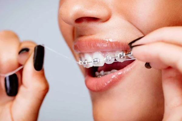 Đâu là địa chỉ nha khoa uy tín tại Cần Giờ mà bạn có thể tin tưởng?