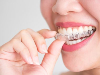 12 địa chỉ nha khoa Quận 9 uy tín tại TPHCM