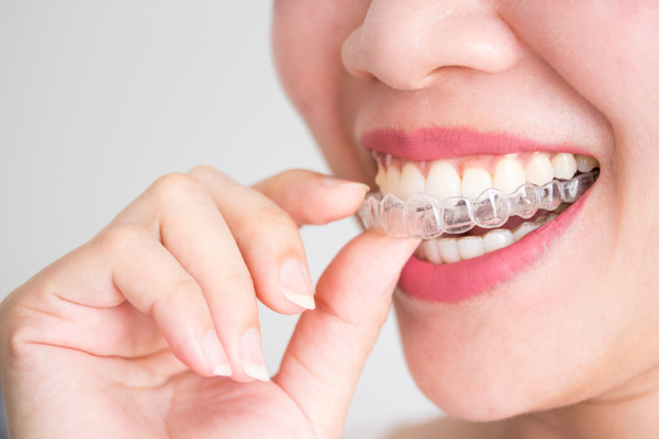 Đâu là địa chỉ nha khoa Quận 9 uy tín TPHCM hiện nay?