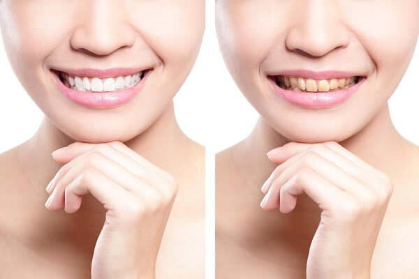 Với 11 năm kinh nghiệm, nha khoa Pháp Việt sẽ đem đến cho bạn nụ cười đẹp nhất